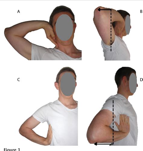 ulnar nerve tests occupational therapy